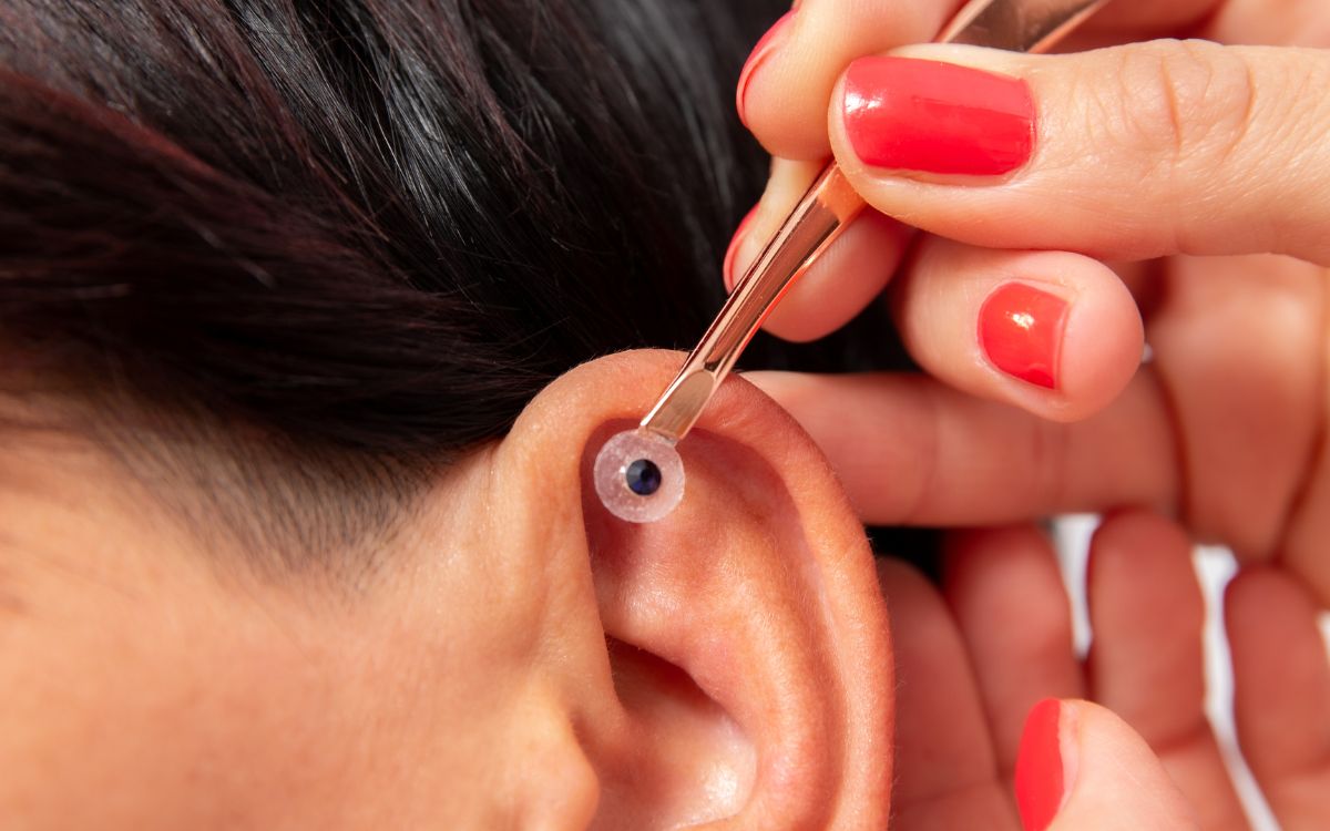 auriculoterapia